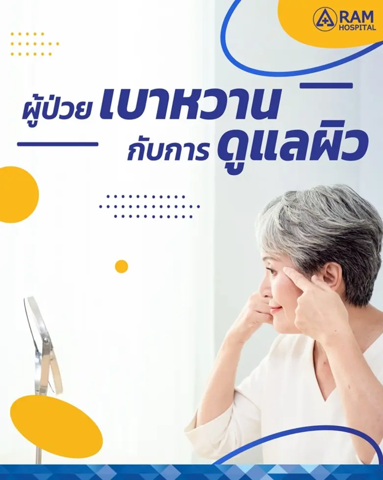 ผู้ป่วยเบาหวาน กับการดูแลผิว