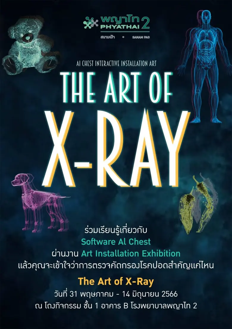 ปัจจุบันโรคมะเร็งปอดนับเป็นมะเร็งที่พบมาก...