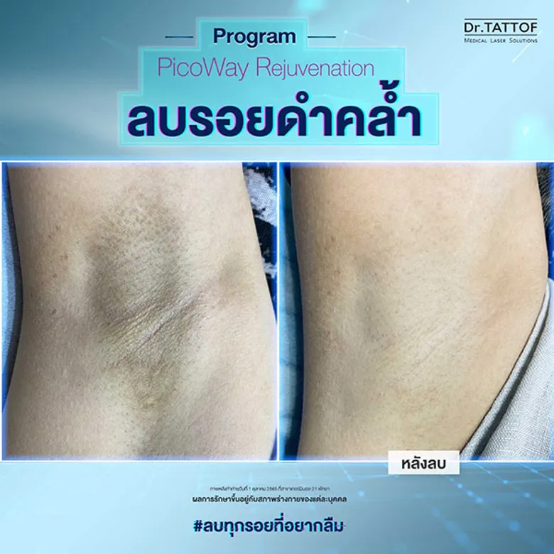 Dr.TATTOF ชวนรีเซ็ตผิวให้กลับมาขาวใสดุจดั่งเพชร: Shine Bright Like a Diamond
