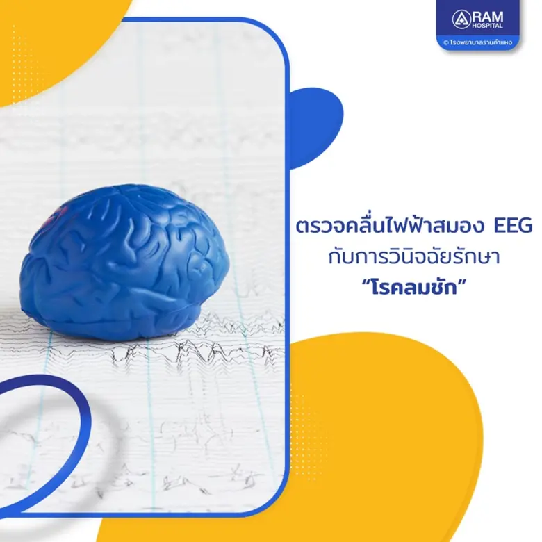 โรคลมชัก เป็นปัญหาสุขภาพที่สามารถพบได้ในค...