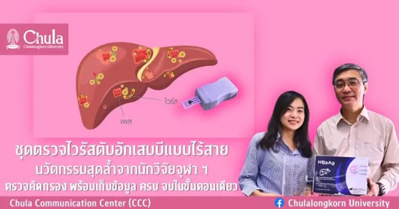 นักวิจัยจุฬาฯ พัฒนาชุดตรวจไวรัสตับอักเสบบ...