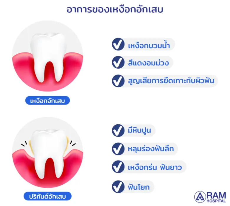 โรคเหงือกอักเสบ อันตรายที่เกิดในช่องปาก