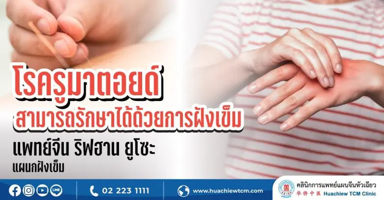 อาการปวดบริเวณข้อต่าง ๆ ของร่างกาย เช่น ข...