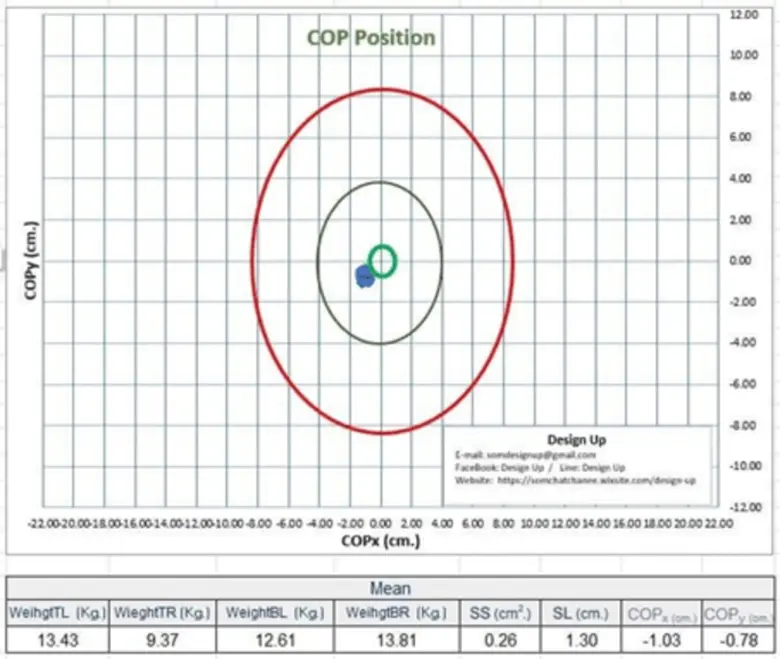 Always on Alert for Balance Loss with "The Balance Assessment Device," An Outstanding Innovation by Chula Researcher
