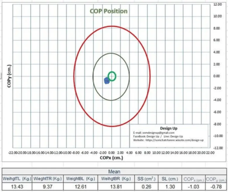 Always on Alert for Balance Loss with "The Balance Assessment Device," An Outstanding Innovation by Chula Researcher