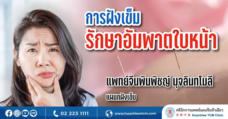 "โรคอัมพาตใบหน้า" เป็นโรคทางระบบประสาทที่...
