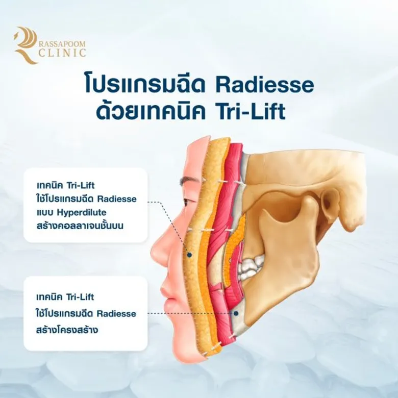 ส่องเทรนด์ความงามปี 2024 โดยอาจารย์นายแพทย์รัสมิ์ภูมิ สุเมธีวิทย์ รัสมิ์ภูมิคลินิก