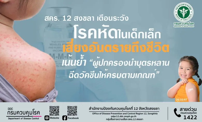 สคร. 12 สงขลา เตือน ระวังโรคหัด ในเด็กเล็ก เสี่ยงอันตรายถึงชีวิต เน้นย้ำ ผู้ปกครองนำบุตรหลานฉีดวัคซีนให้ครบตามเกณฑ์
