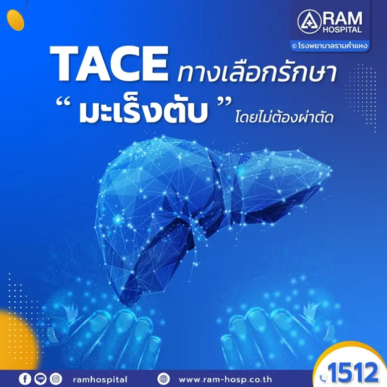มะเร็งตับ หลายคนอาจเข้าใจว่าการรักษาหลักค...