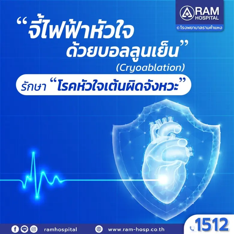 "จี้ไฟฟ้าหัวใจด้วยบอลลูนเย็น" (Cryoablati...