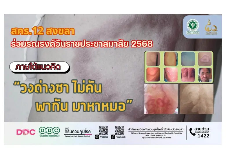 สำนักงานป้องกันควบคุมโรคที่ 12 จังหวัดสงข...