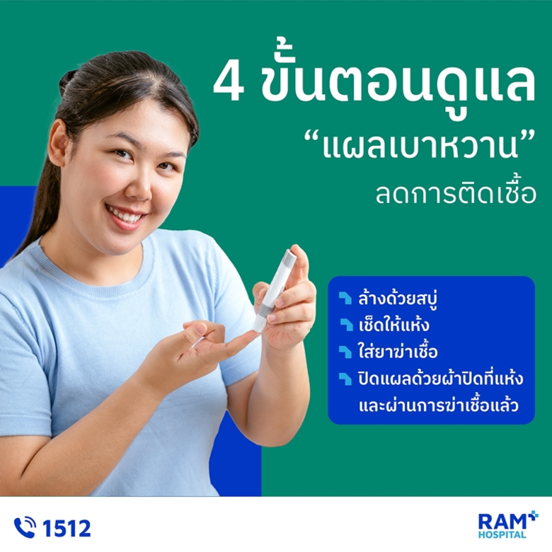 4 ขั้นตอนดูแล "แผลเบาหวาน" ลดการติดเชื้อ ...