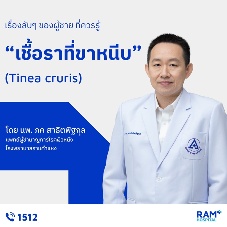 เชื้อราที่ขาหนีบ (Tinea cruris) เป็นโรคติ...