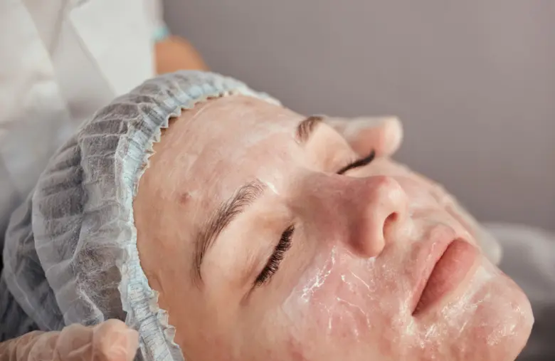 โปรแกรมรักษารอยสิวด้วยเทคโนโลยี DAS