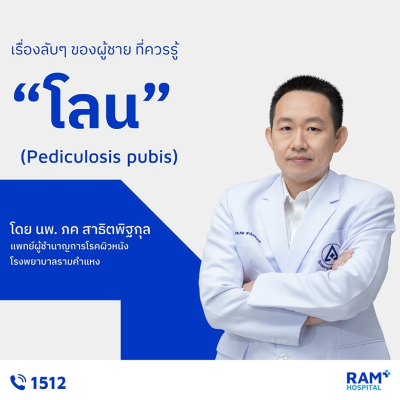 โลน (Pediculosis pubis) หลายคนอาจจะเคยได้...