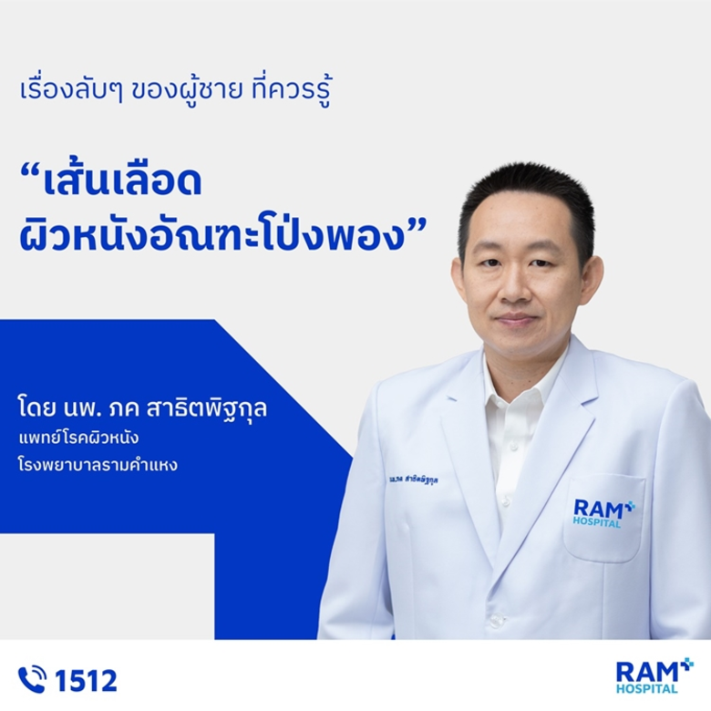 เส้นเลือดผิวหนังอัณฑะโป่งพอง (Angiokerato...