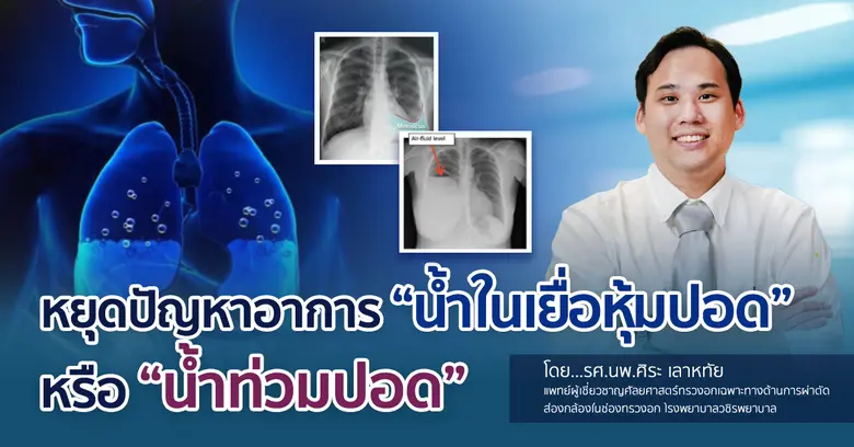 รศ.นพ.ศิระ เลาหทัย แพทย์ผู้เชี่ยวชาญศัลยศ...