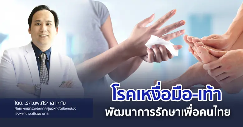 โรคเหงื่อมือ-เท้า อาจจะยังไม่เป็นที่รู้จั...