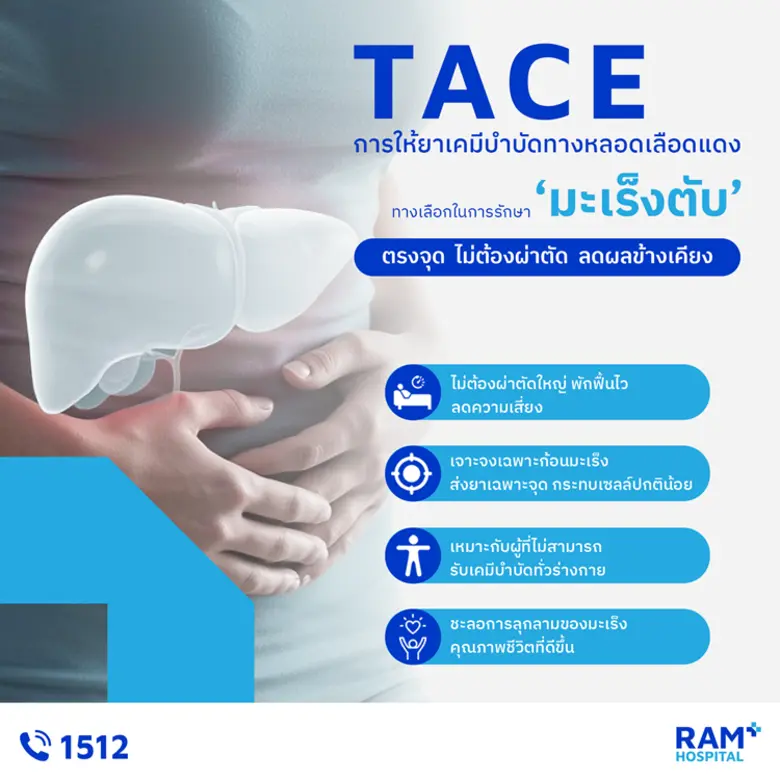 TACE การให้ยาเคมีบำบัดทางหลอดเลือดแดงทางเ...
