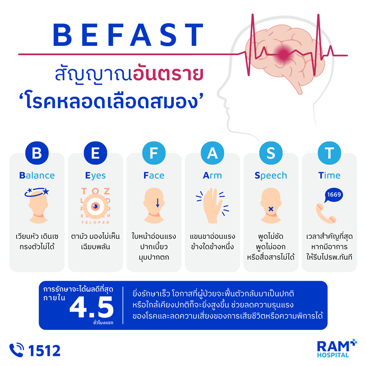 BEFAST สัญญาณอันตราย "โรคหลอดเลือดสมอง" โ...