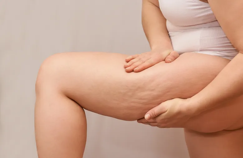 ไขข้อสงสัยเรื่องดูดไขมัน คืออะไร? ทำตำแหน่งไหนได้บ้าง?