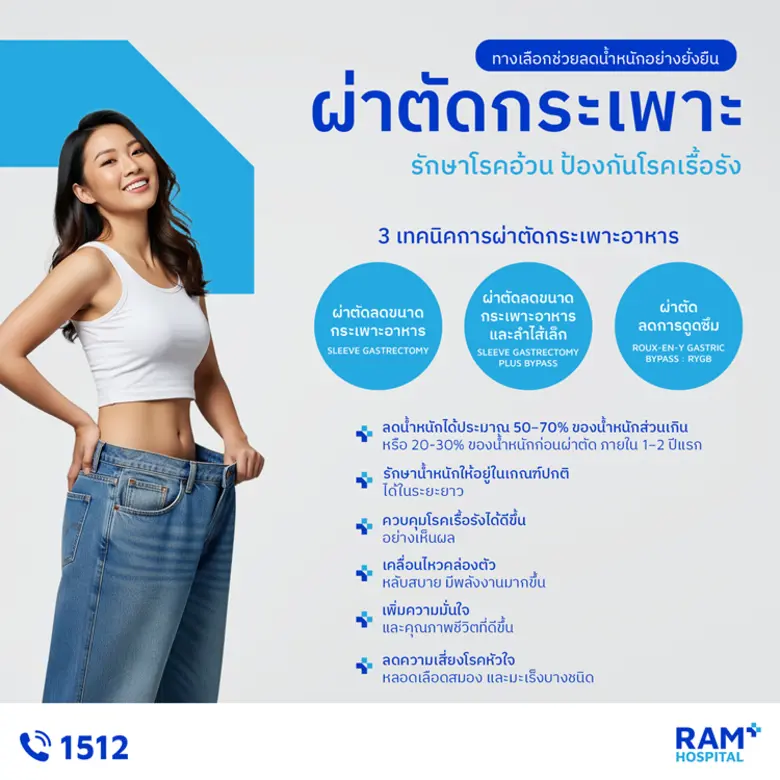 "ผ่าตัดกระเพาะ" ทางเลือกช่วยลดน้ำหนักอย่า...