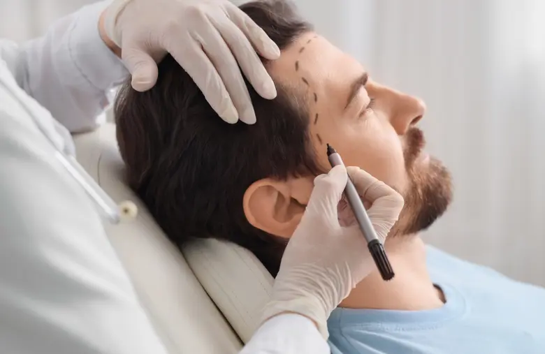 สำหรับผู้ที่ตัดสินใจแก้ไขปัญหาผมบางหรือศี...