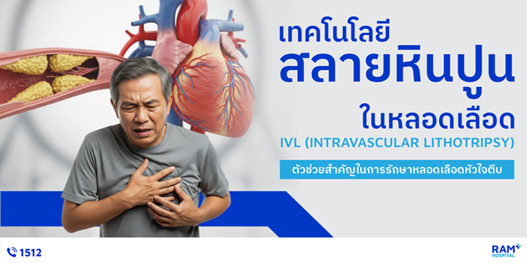 IVL เทคโนโลยีสลายหินปูนในหลอดเลือด ตัวช่ว...