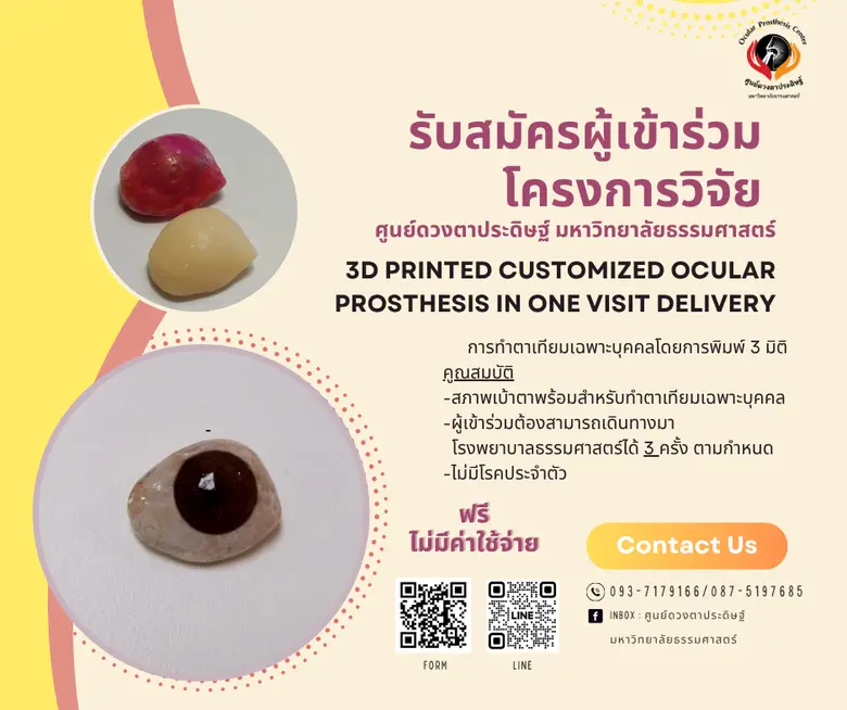 เชิญเข้าร่วมโครงการวิจัยเพื่อทำตาเทียมเฉพ...