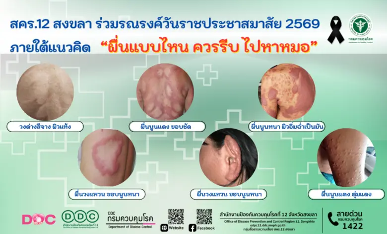 สำนักงานป้องกันควบคุมโรคที่ 12 จังหวัดสงข...