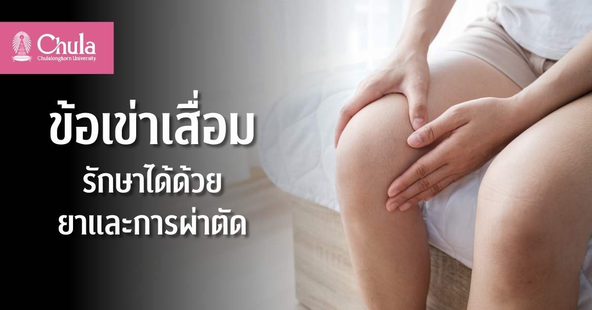 ข้อเข่าเสื่อม โรคเสี่ยงของคนวัย 60 ปีขึ้น...