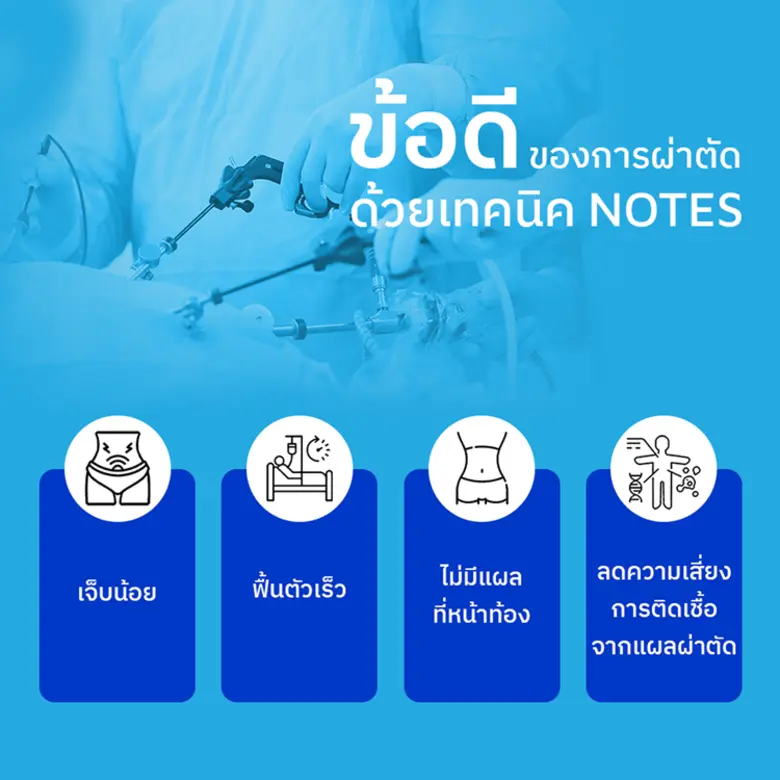 ผ่าตัดมดลูกไร้แผล ด้วยเทคนิค NOTESนวัตกรร...