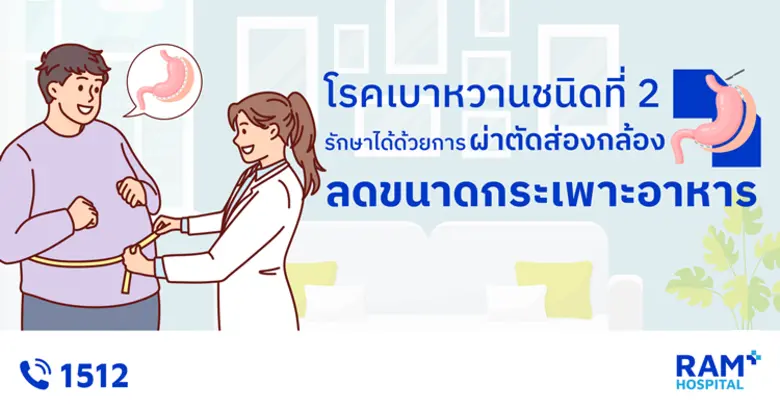 เมื่อพูดถึง "ผ่าตัดลดขนาดกระเพาะ" หลายคนอ...