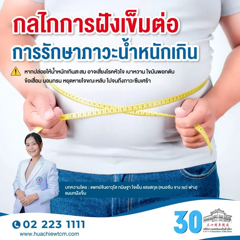 การฝังเข็มไม่ได้เน้นลดตัวเลขบนตาชั่ง แต่เ...