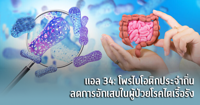 แพทยศาสตร์ จุฬา วิจัยค้นพบโพรไบโอติกแลคโต...