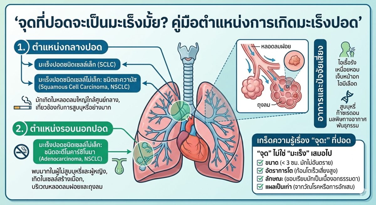 "เจอจุดที่ปอด" ต้องกังวลแค่ไหน?