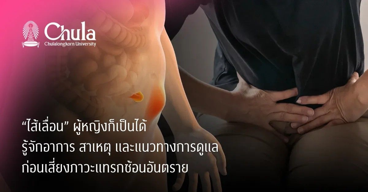"ไส้เลื่อนในผู้หญิง" แม้ไม่ใช่โรคที่ถูกพู...