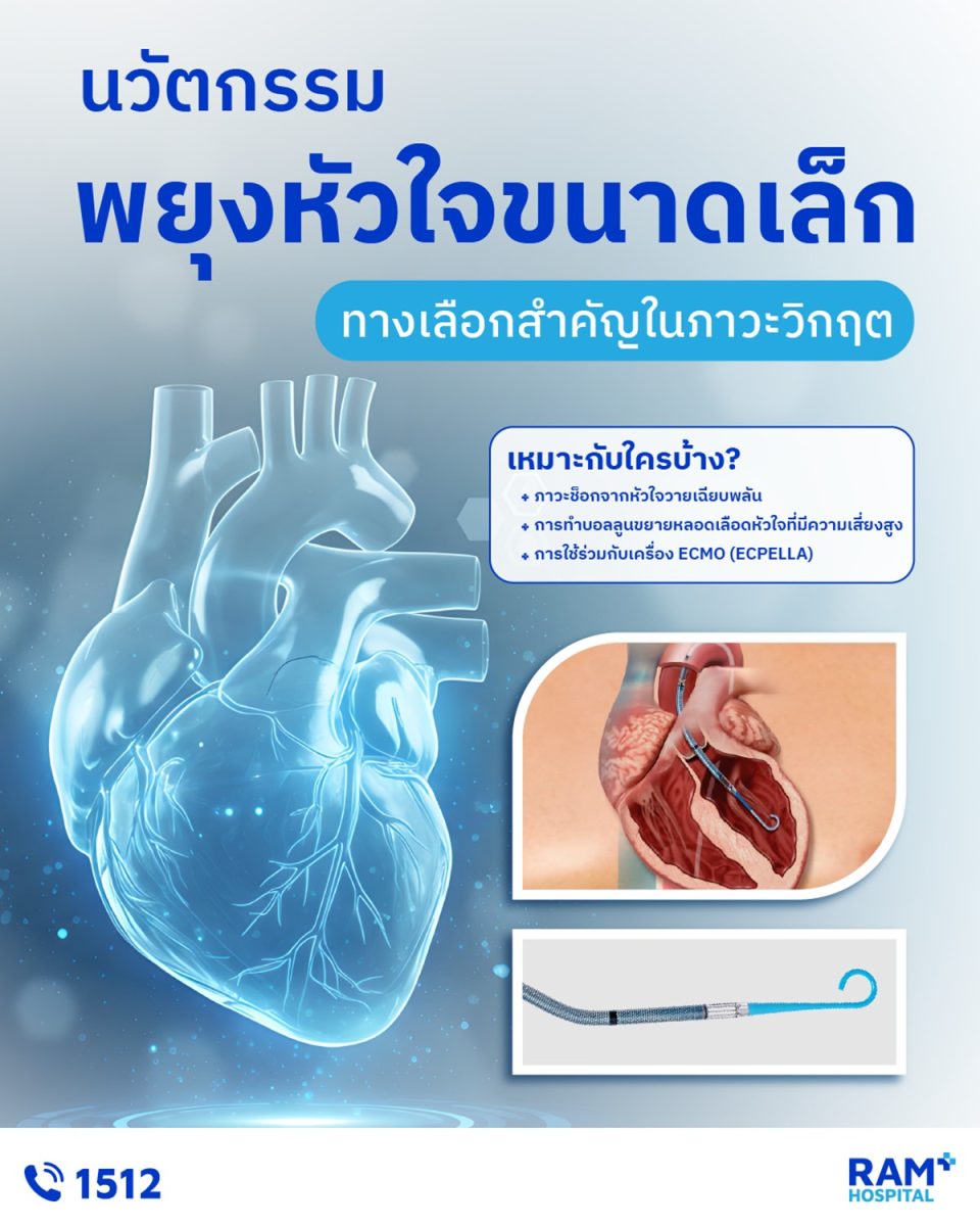 อิมเพลลล่า (Impella) คืออุปกรณ์ช่วยพยุงหั...