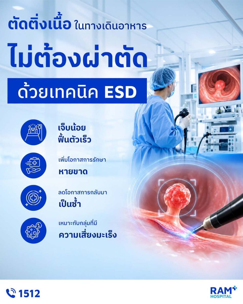 เทคนิค ESD (Endoscopic Submucosal Dissect...