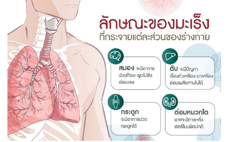 เมื่อมะเร็งกระจายมาที่ปอด… การผ่าตัดยังเป็นความหวังของผู้ป่วยบางราย