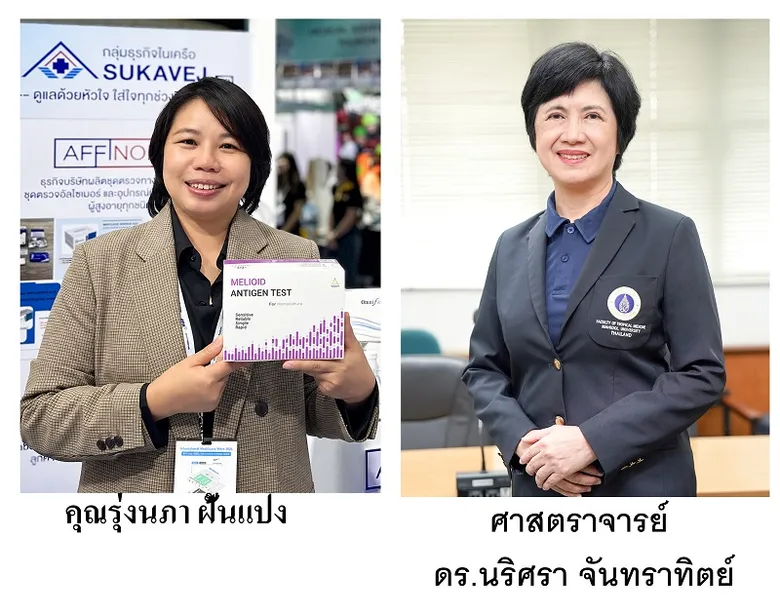 คณะเวชศาสตร์เขตร้อน มหาวิทยาลัยมหิดลร่วมมือบริษัท แอฟฟิโนม จำกัด ร่วมผลิตชุดตรวจช่วยผู้ป่วยได้รับการวินิจฉัยโรคไข้ดินอย่างรวดเร็ว