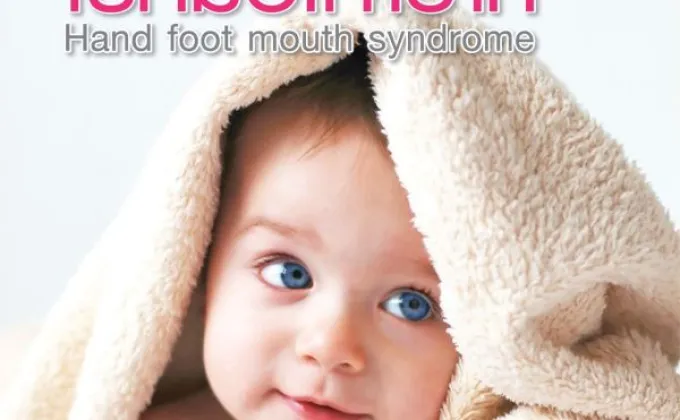 โรค มือ เท้าปาก Hand Foot Mouth