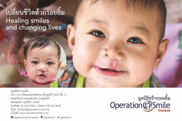 มูลนิธิสร้างรอยยิ้ม จัดกิจกรรมระดมทุน ผ่าตัดเด็กปากแหว่งเพดานโหว่ทั่วไทย