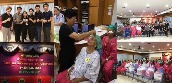 ภาพข่าว: PECF ออกหน่วยแพทย์เคลื่อนที่ผ่าตัดตาต้อกระจก ณ โรงพยาบาลบ้านลาด จ.เพชรบุรี