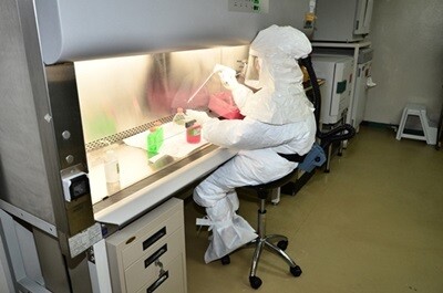 กรมวิทย์ฯมั่นใจความพร้อมห้องปฏิบัติการรับมือไวรัสอีโบลาและโรคอุบัติใหม่