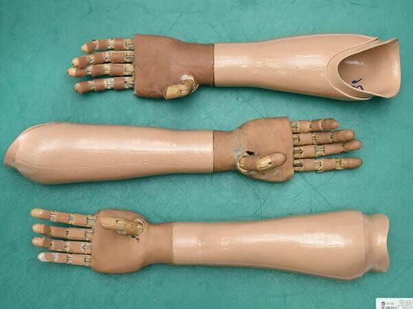 อาชีวะร่วมมือมูลนิธิสายใจไทยในพระบรมราชูปถัมภ์ฯ ผลิตมือกล (Bionic Hand) เพื่อยกระดับคุณภาพการดำรงชีวิตผู้พิการทางมือ