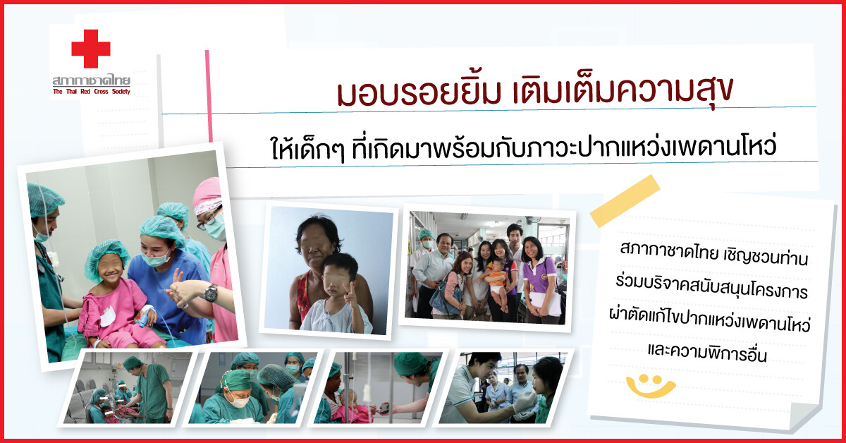สภากาชาดไทย เชิญชวนร่วมบริจาค "มอบรอยยิ้ม เติมเต็มความสุข" ผู้ป่วยเด็กปากแหว่งเพดานโหว่