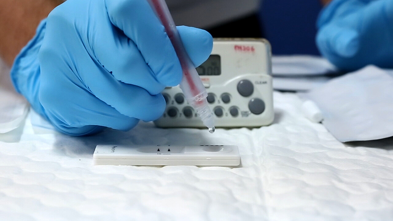 กรมวิทย์ฯ แนะแนวทางการใช้ Antigen Test Kit ในการตรวจการติดเชื้อโควิด 19