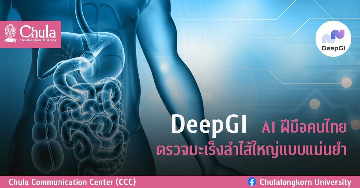 DeepGI AI ฝีมือคนไทย ตรวจมะเร็งลำไส้ใหญ่แบบแม่นยำ
