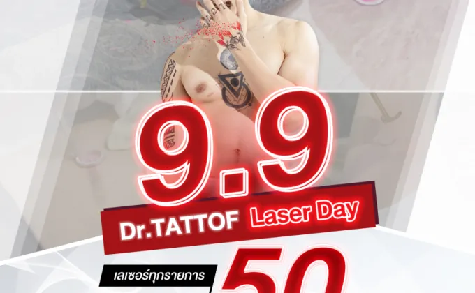Dr.TATTOF จัดโปร 9.9 Laser Day